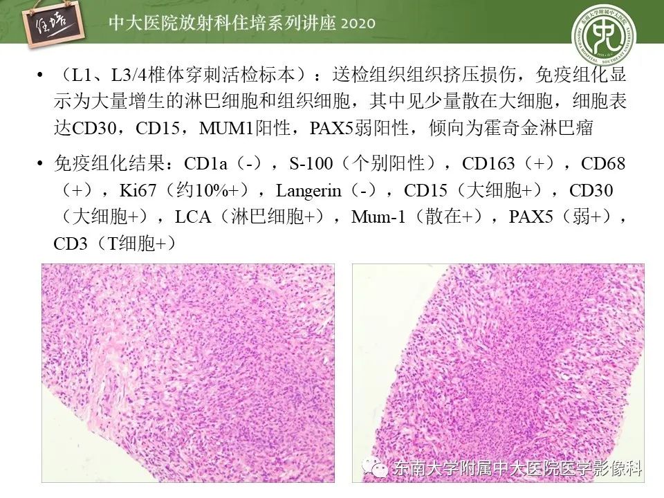 【PPT】脊柱骨源性病变影像分析思路及应用