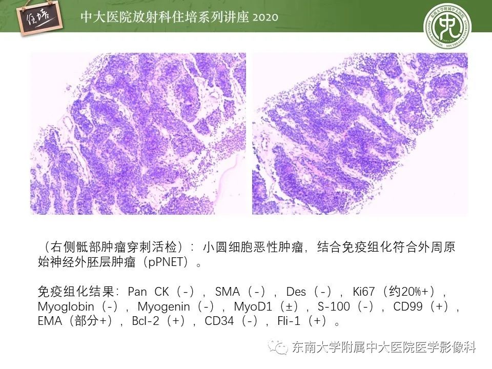 【PPT】脊柱骨源性病变影像分析思路及应用