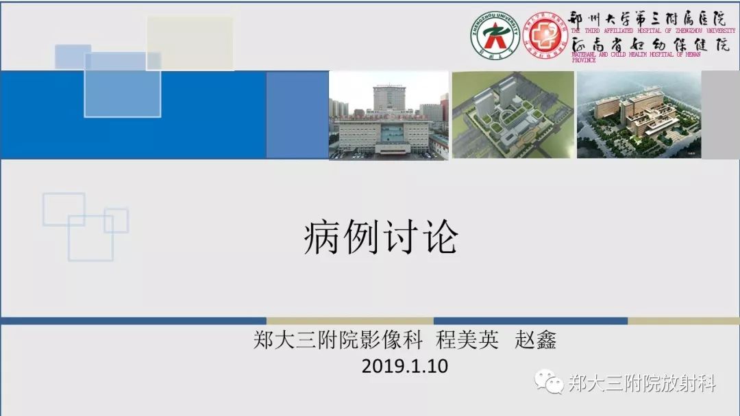 【PPT】DiGeorge迪格奥尔格综合征