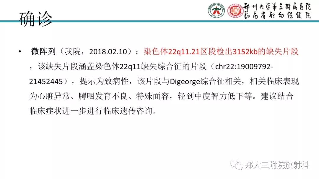 【PPT】DiGeorge迪格奥尔格综合征