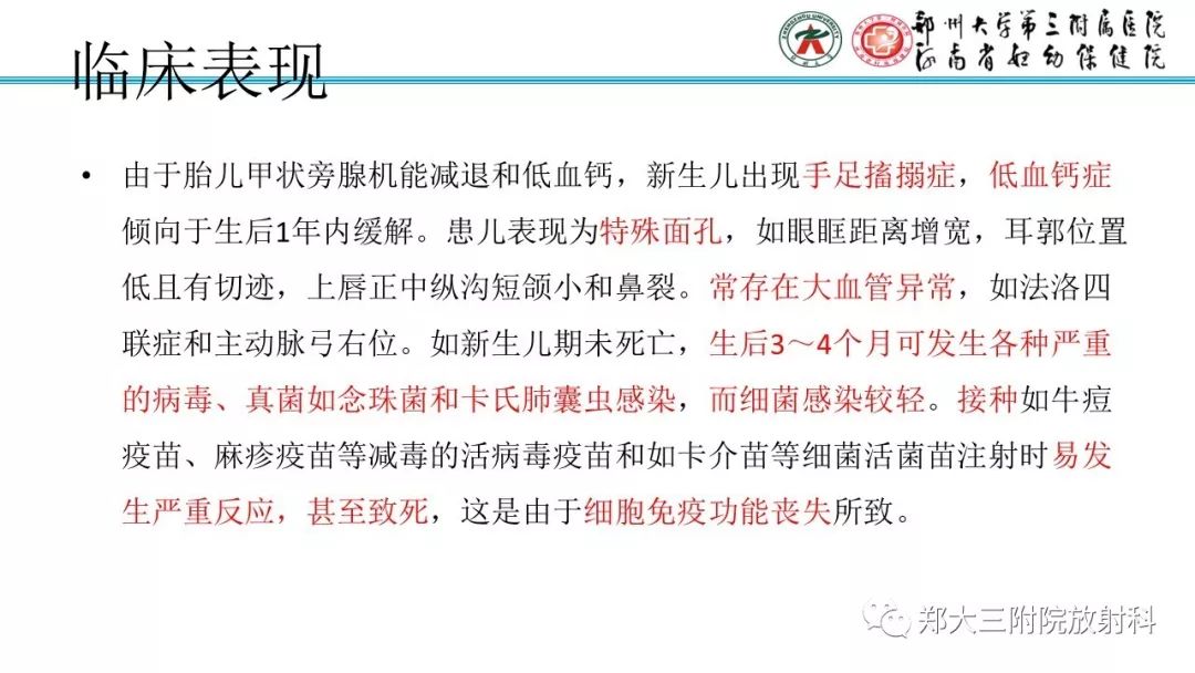 【PPT】DiGeorge迪格奥尔格综合征