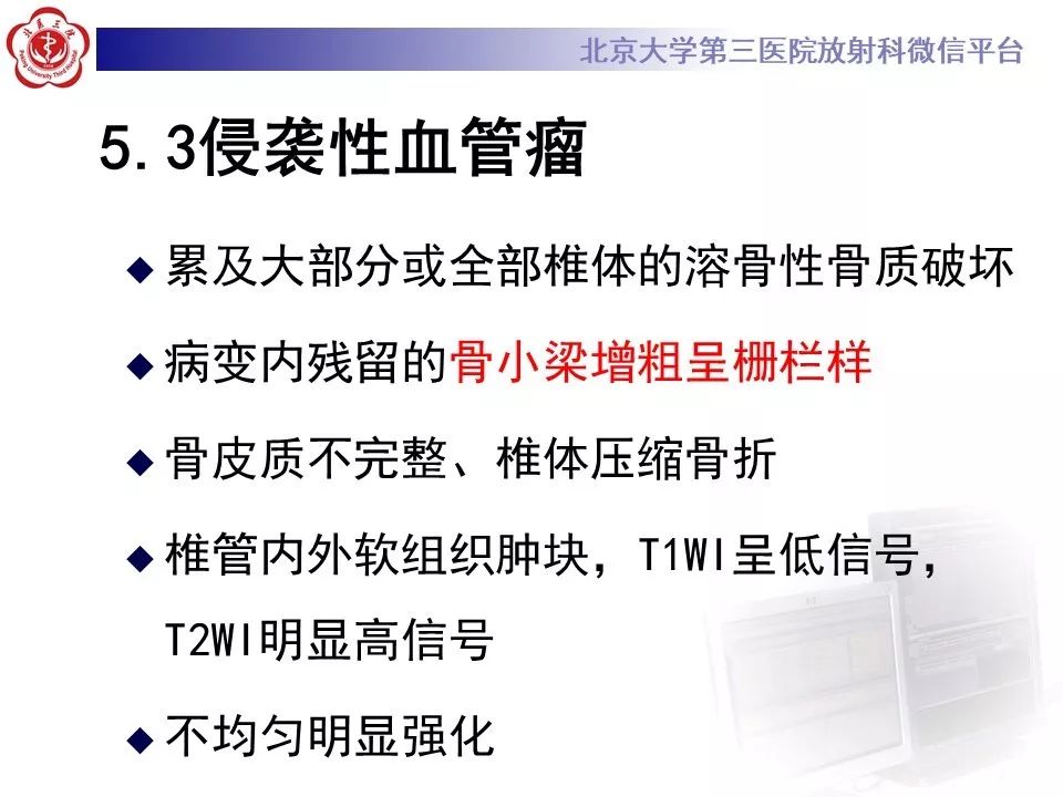 【PPT】原发性脊柱软骨肉瘤