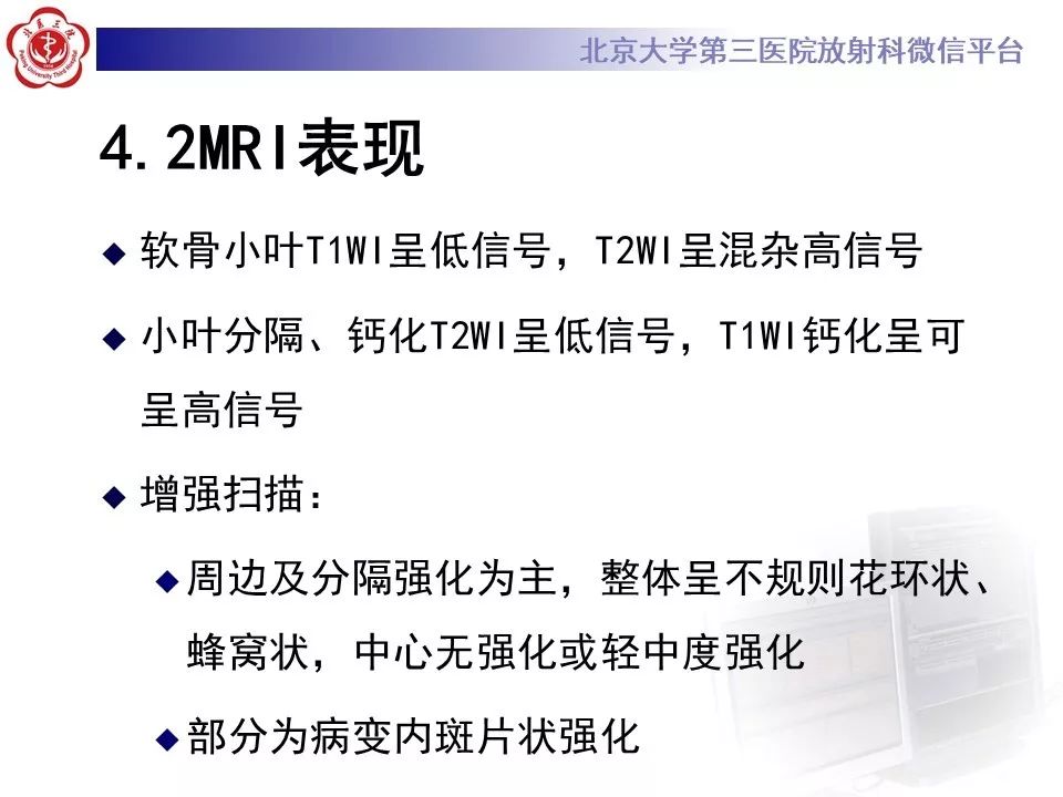 【PPT】原发性脊柱软骨肉瘤