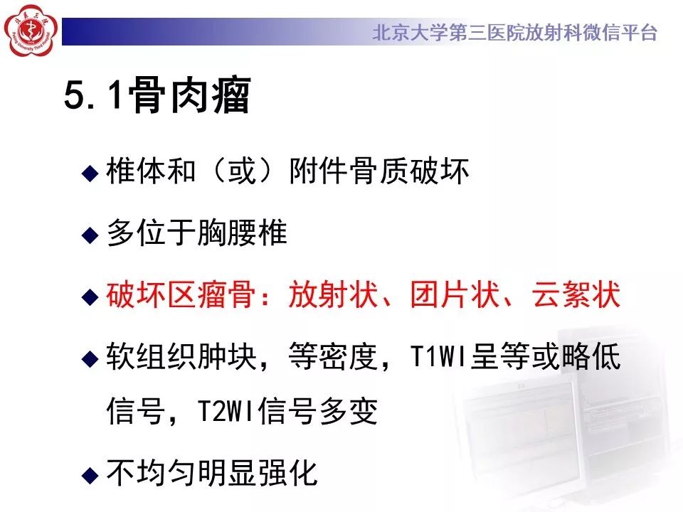 【PPT】原发性脊柱软骨肉瘤
