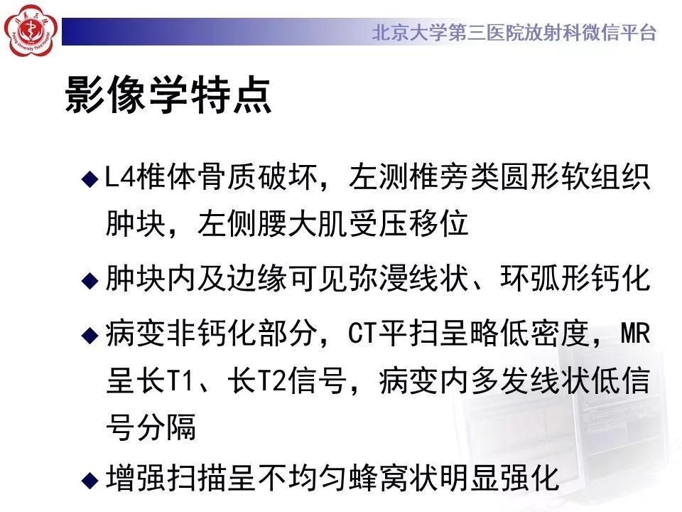 【PPT】原发性脊柱软骨肉瘤