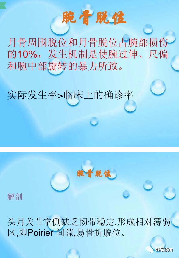 腕骨脱位的分类及X线表现