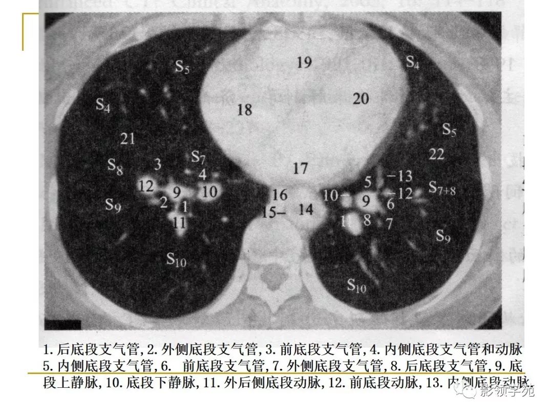 肺段与肺内管道应用解剖