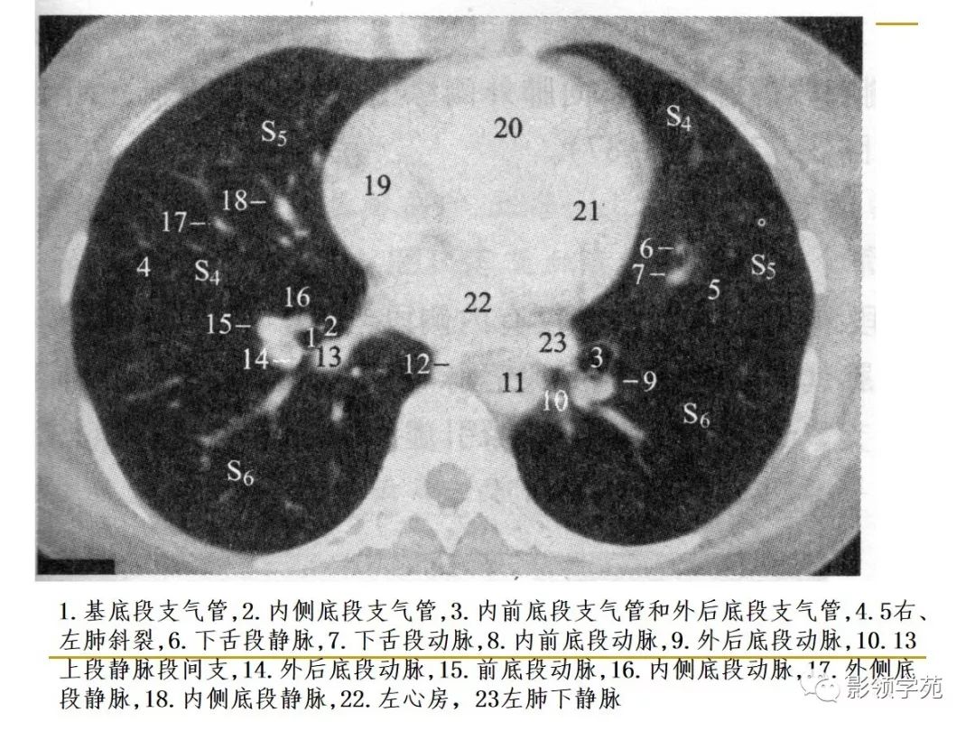肺段与肺内管道应用解剖