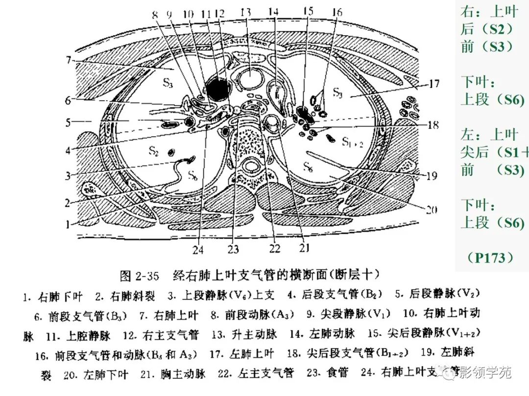 肺段与肺内管道应用解剖 肺段与肺内管道应用解剖