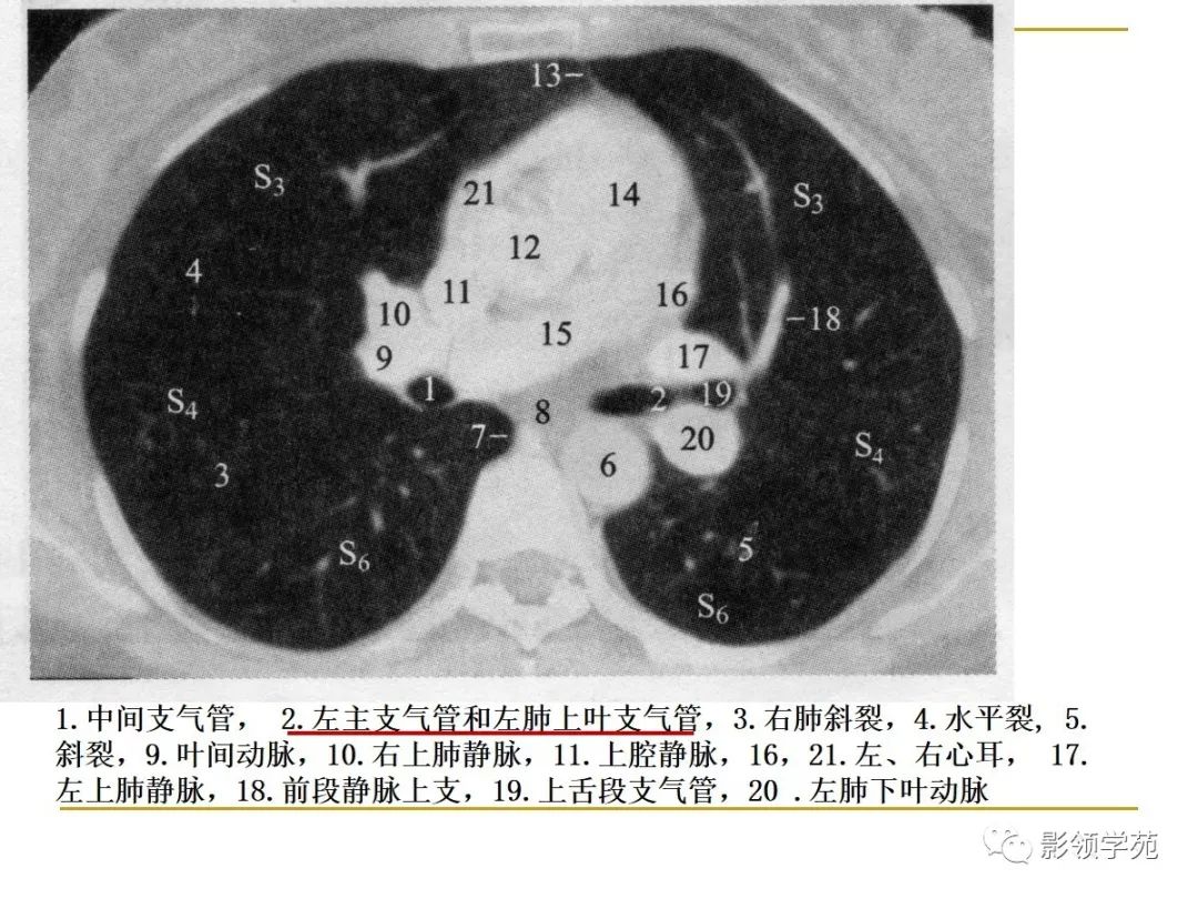 肺段与肺内管道应用解剖