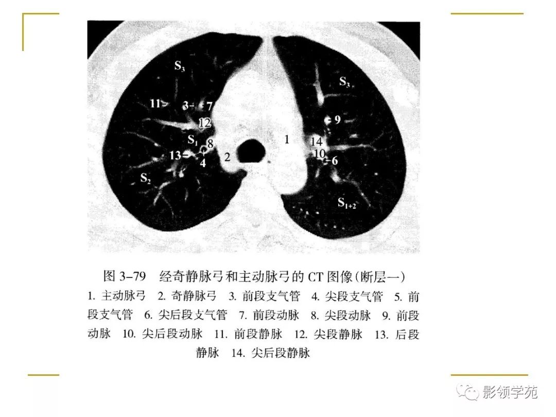 肺段与肺内管道应用解剖