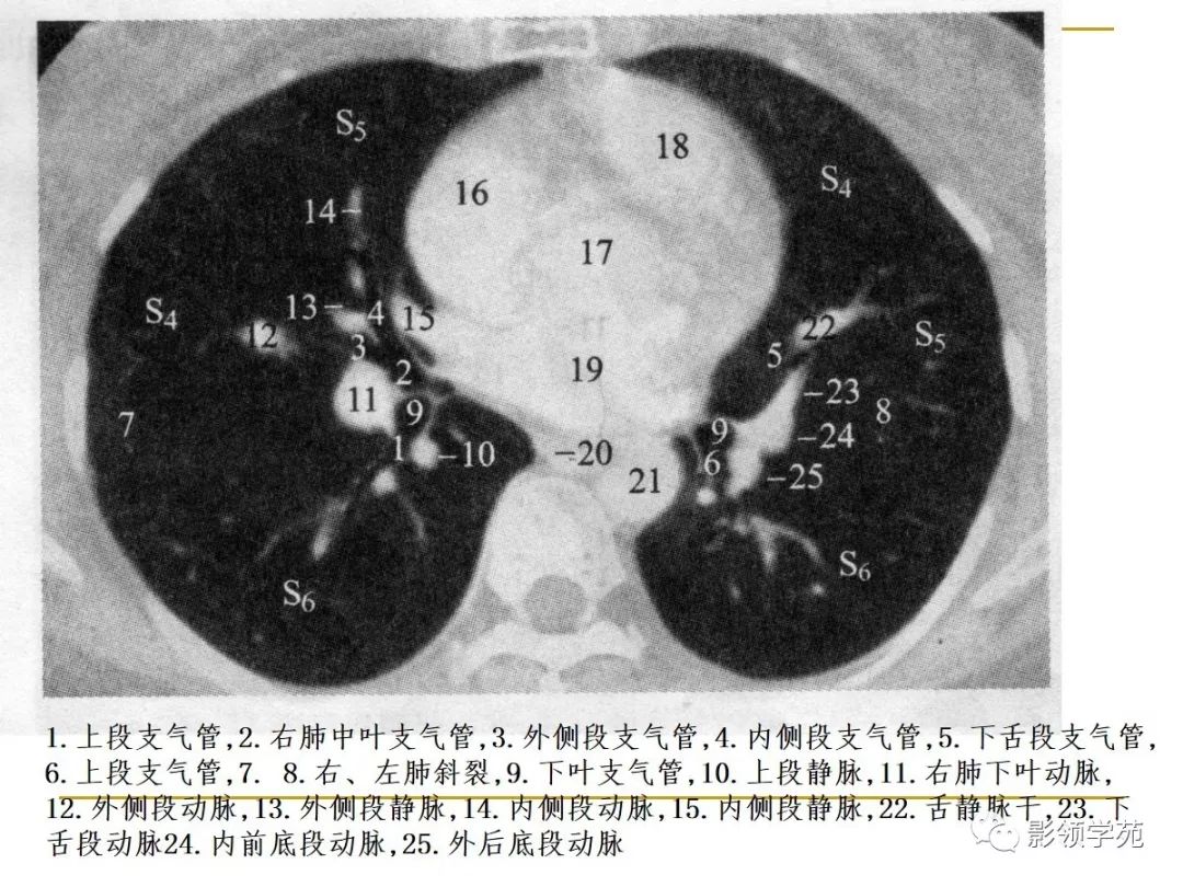肺段与肺内管道应用解剖