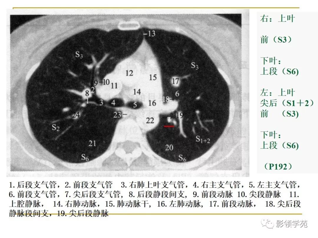 肺段与肺内管道应用解剖