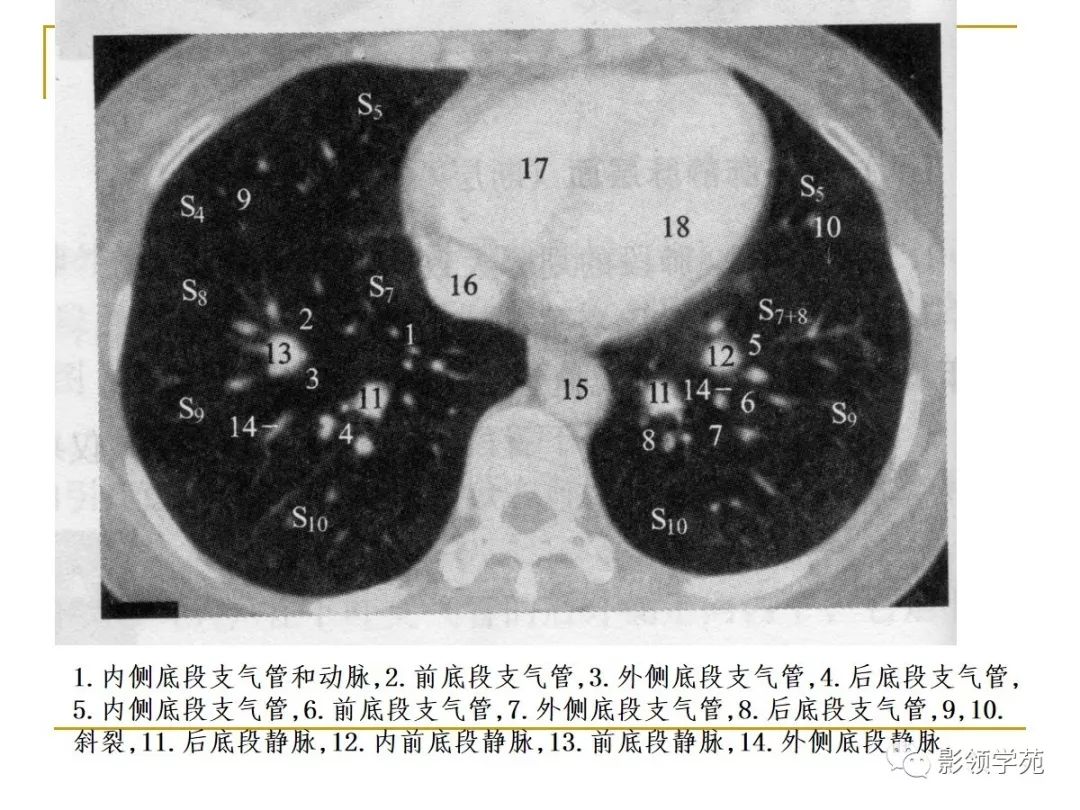 肺段与肺内管道应用解剖