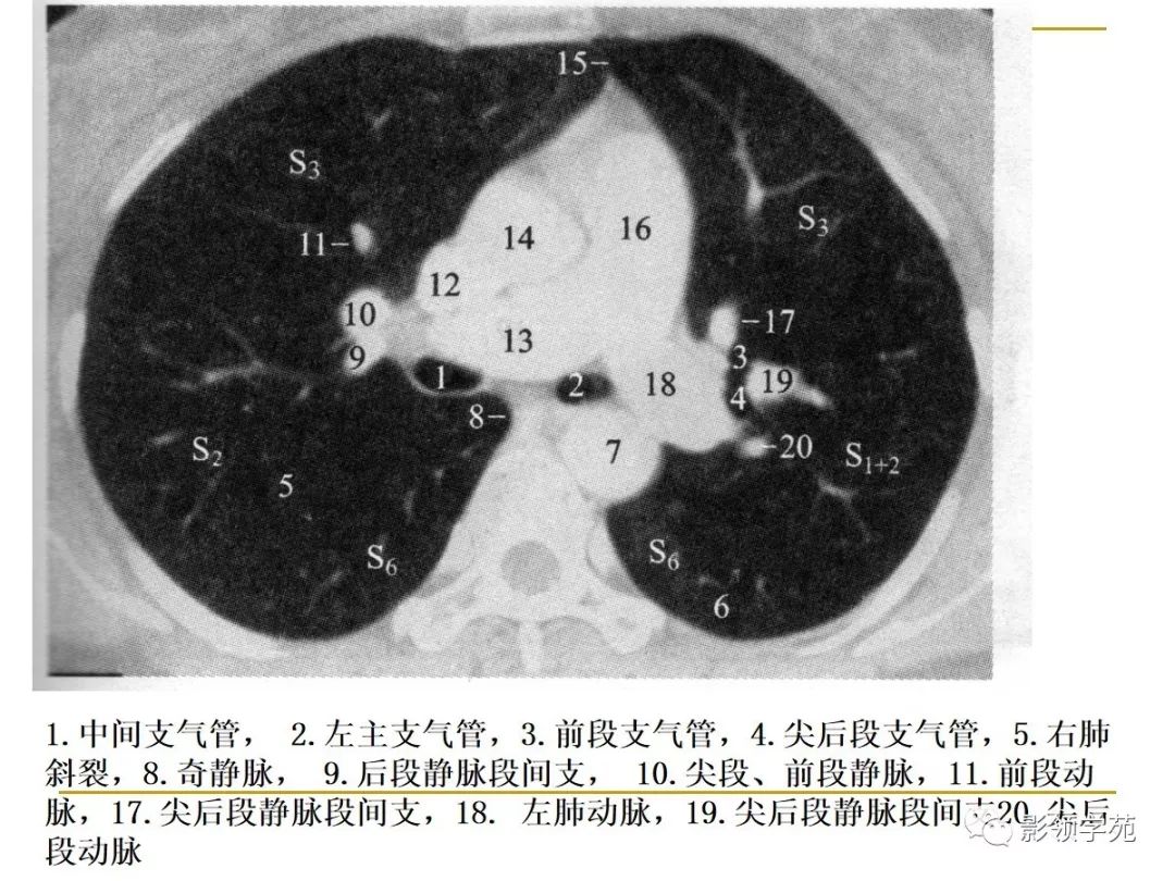 肺段与肺内管道应用解剖
