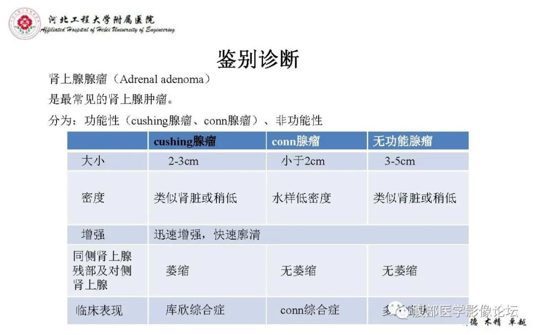 【PPT】肾上腺神经鞘瘤