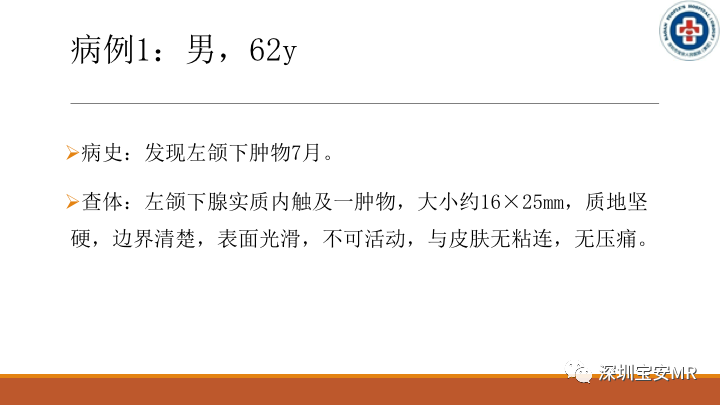 【病例】颌下腺腺样囊腺癌1例CT影像