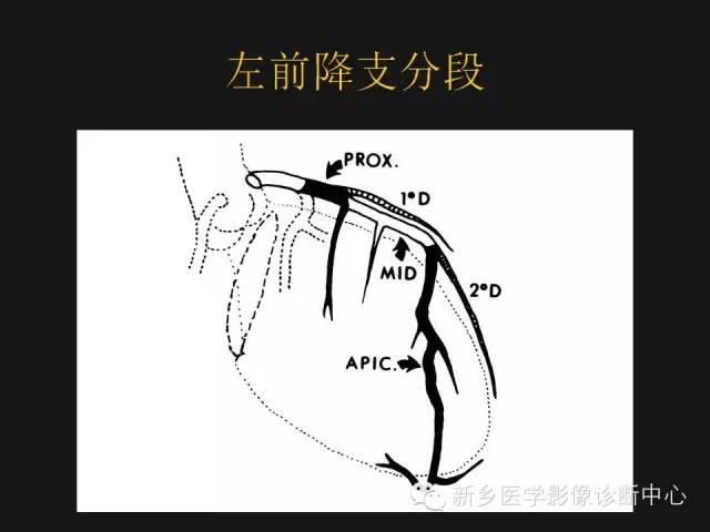 【PPT】冠状动脉造影正常解剖