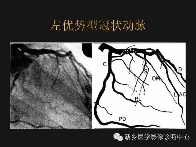 【PPT】冠状动脉造影正常解剖