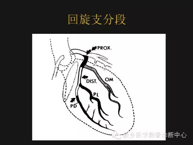 【PPT】冠状动脉造影正常解剖