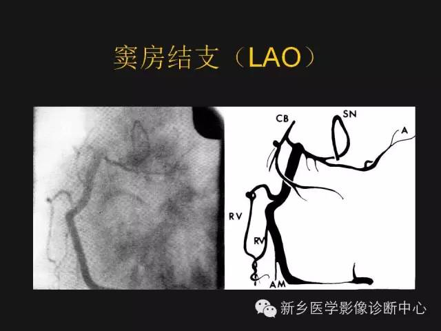 【PPT】冠状动脉造影正常解剖