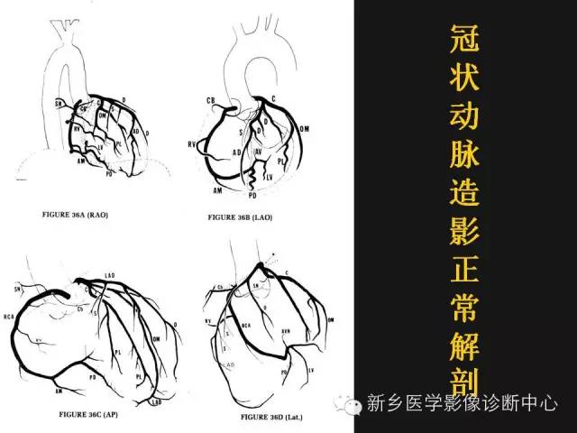 【PPT】冠状动脉造影正常解剖