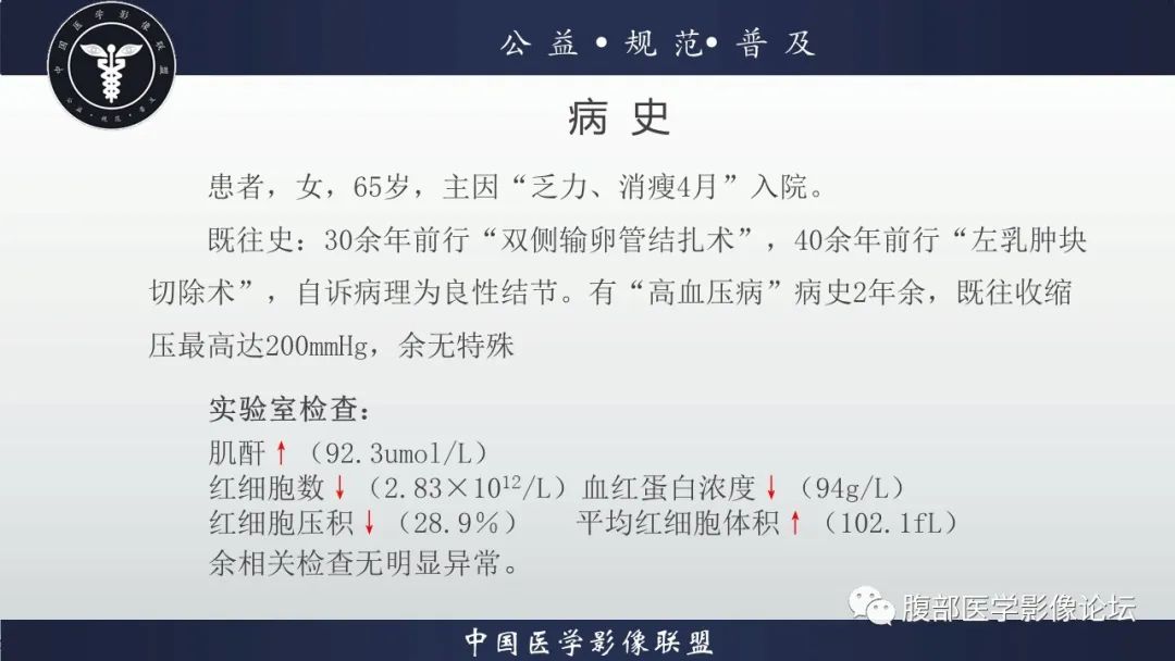 【病例】肾脏乳头状肾细胞癌1例CT及MR影像讨论
