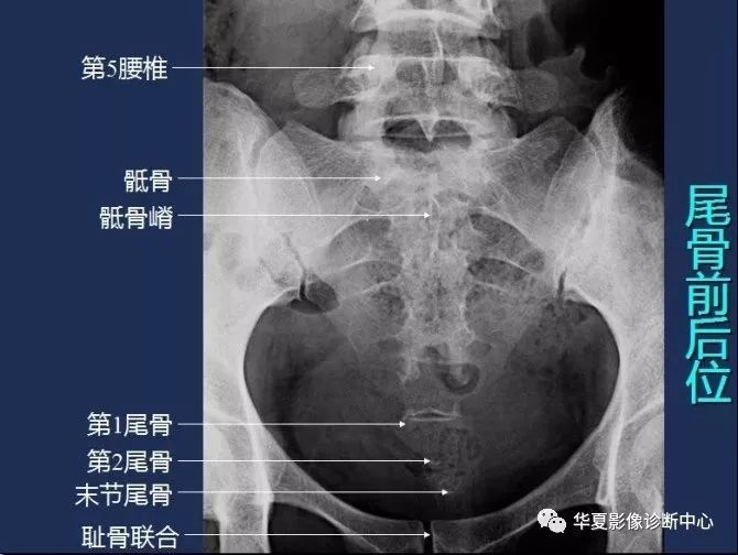 X线解剖图谱+系统解剖（骨骼篇）
