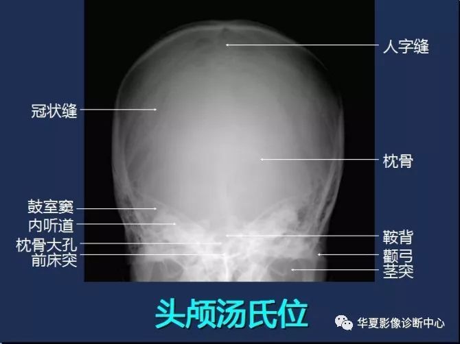 X线解剖图谱+系统解剖（骨骼篇）