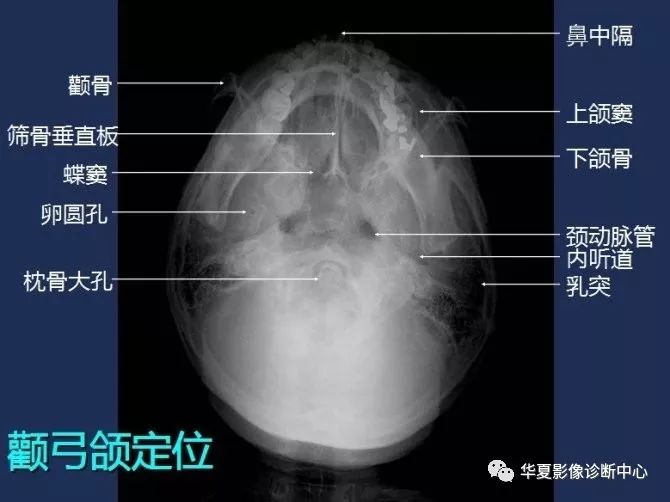 X线解剖图谱+系统解剖（骨骼篇）