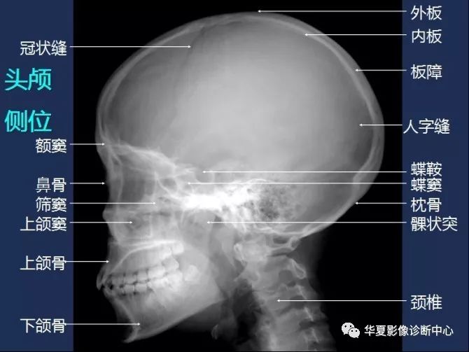 X线解剖图谱+系统解剖（骨骼篇）