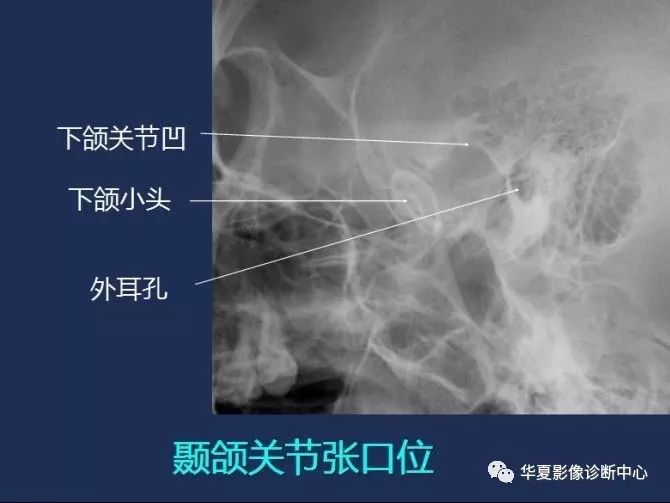 X线解剖图谱+系统解剖（骨骼篇）