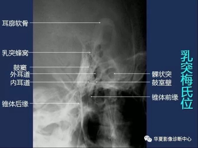X线解剖图谱+系统解剖（骨骼篇）