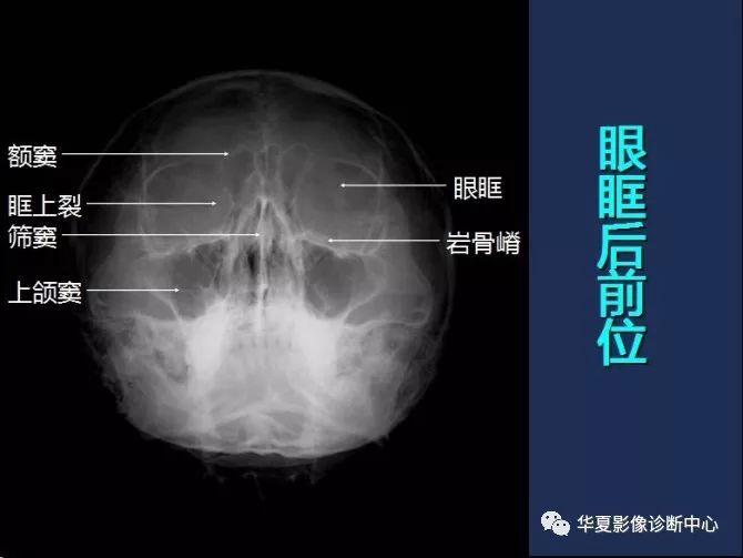 X线解剖图谱+系统解剖（骨骼篇）