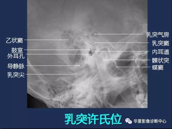 X线解剖图谱+系统解剖（骨骼篇）