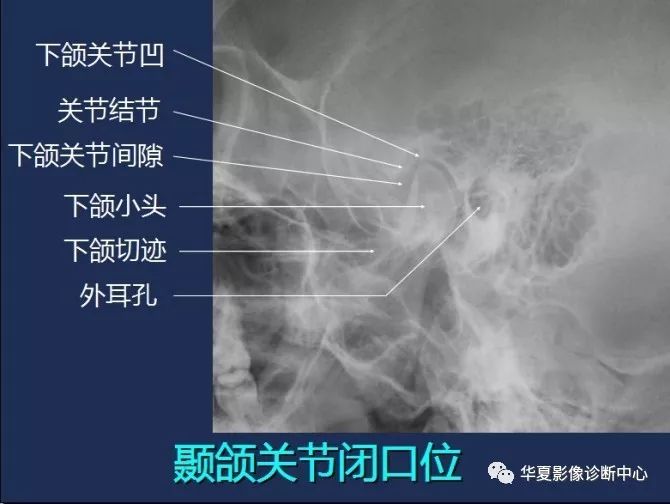 X线解剖图谱+系统解剖（骨骼篇）