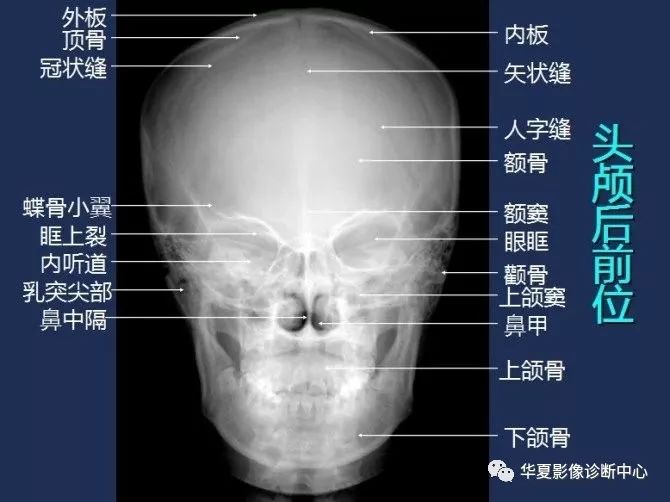 X线解剖图谱+系统解剖（骨骼篇）