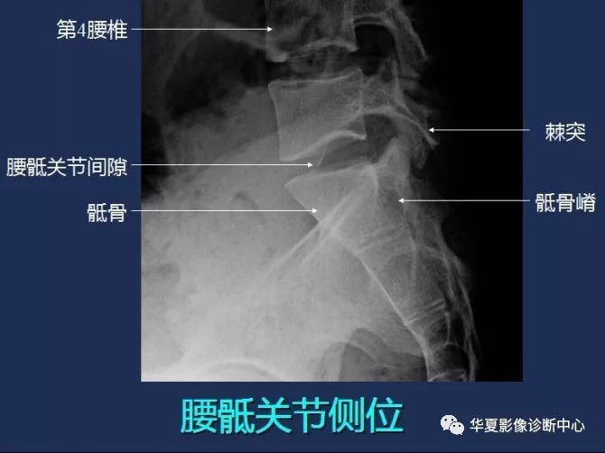 X线解剖图谱+系统解剖（骨骼篇）