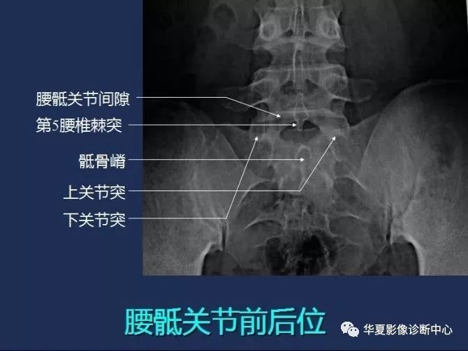 X线解剖图谱+系统解剖（骨骼篇）