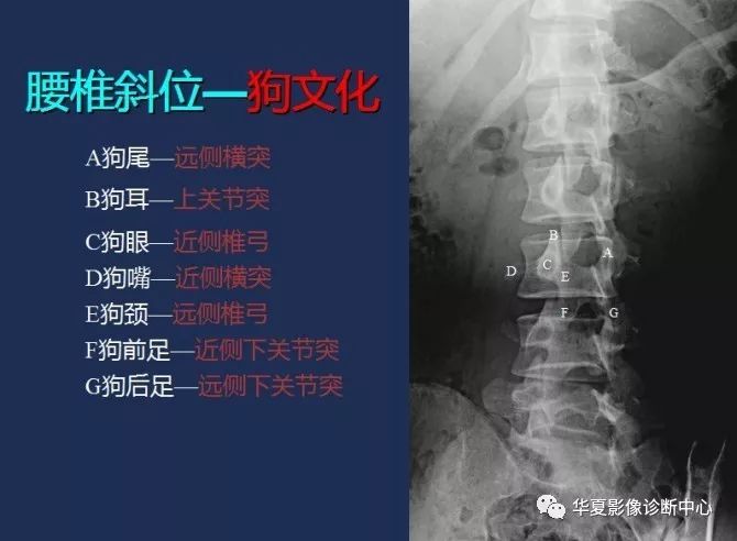 X线解剖图谱+系统解剖（骨骼篇）