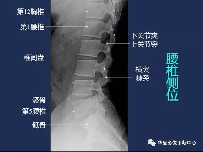 X线解剖图谱+系统解剖（骨骼篇）