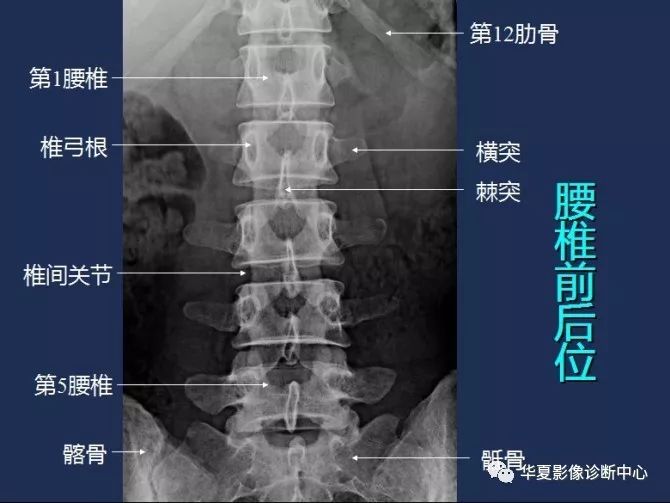 X线解剖图谱+系统解剖（骨骼篇）