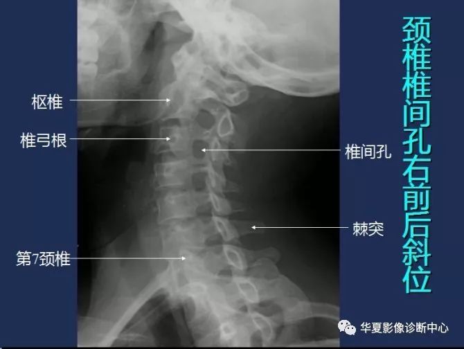 X线解剖图谱+系统解剖（骨骼篇）