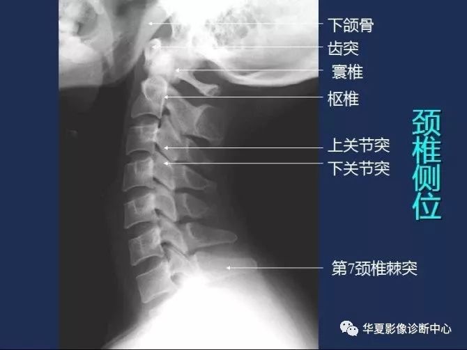 X线解剖图谱+系统解剖（骨骼篇）