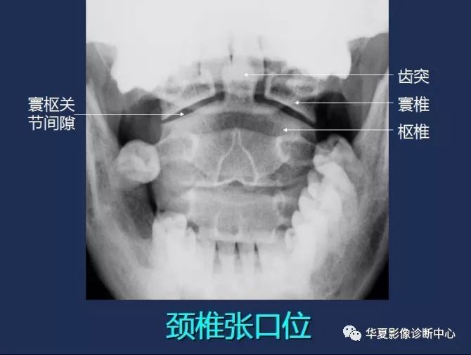 X线解剖图谱+系统解剖（骨骼篇）