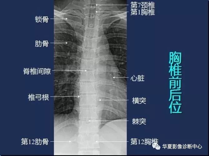 X线解剖图谱+系统解剖（骨骼篇）