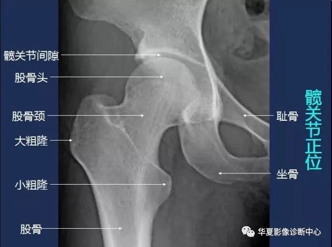 X线解剖图谱+系统解剖（骨骼篇）