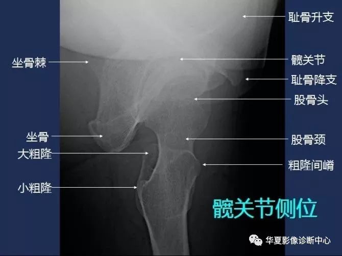 X线解剖图谱+系统解剖（骨骼篇）