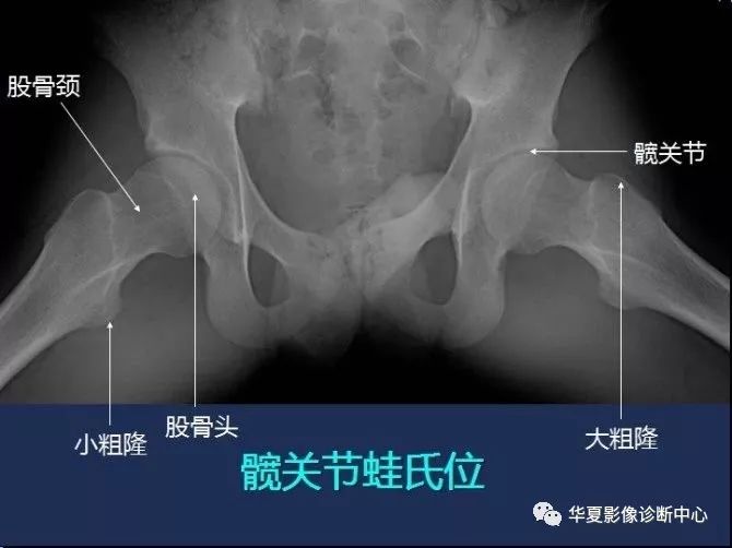 X线解剖图谱+系统解剖（骨骼篇）