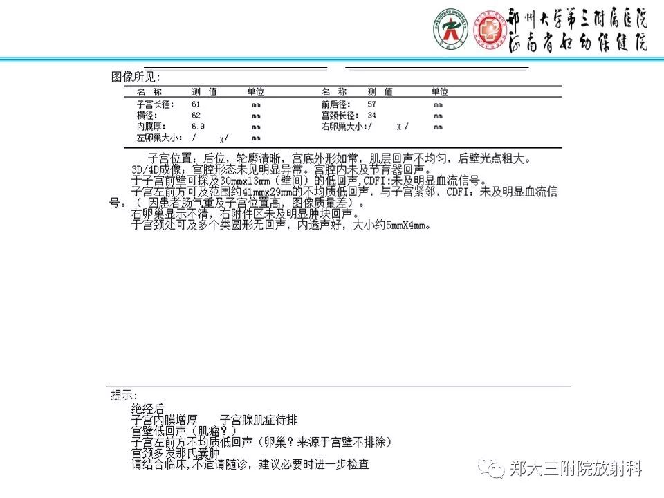 【PPT】腹壁子宫内膜异位症